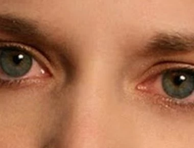 Αλλεργία στα μάτια: Αντιμετώπιση για φαγούρα, κοκκίνισμα και δάκρυα